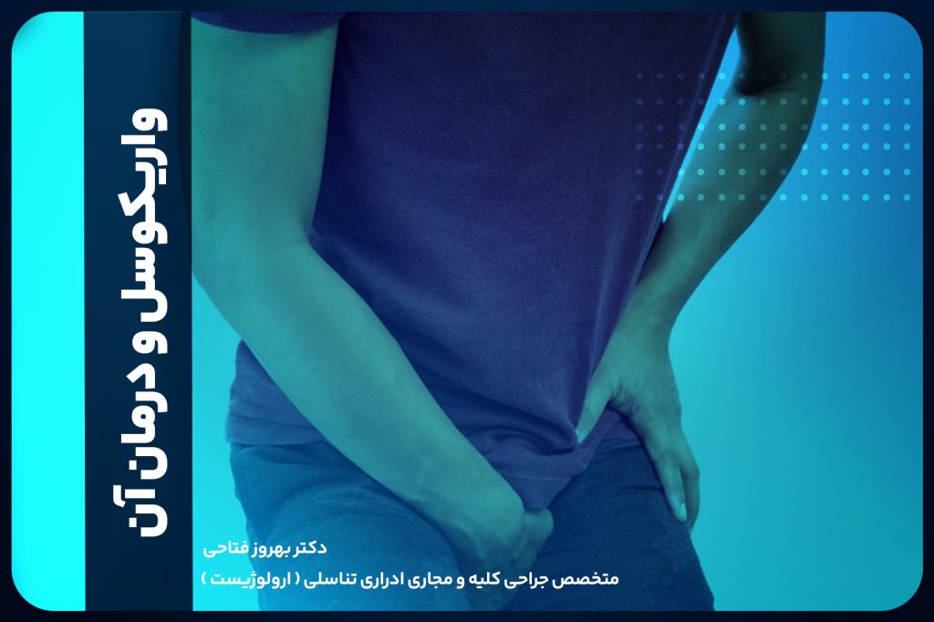 واریکوسل و درمان آن