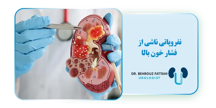 نفروپاتی ناشی از فشار خون بالا