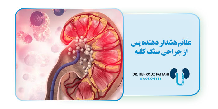 علائم هشداردهنده پس از جراحی سنگ کلیه