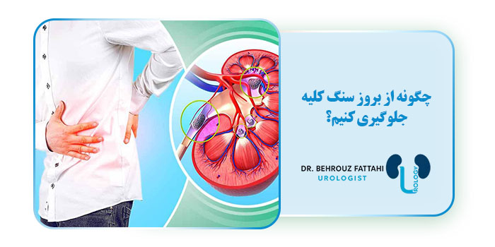 چگونه از بروز سنگ کلیه جلوگیری کنیم؟