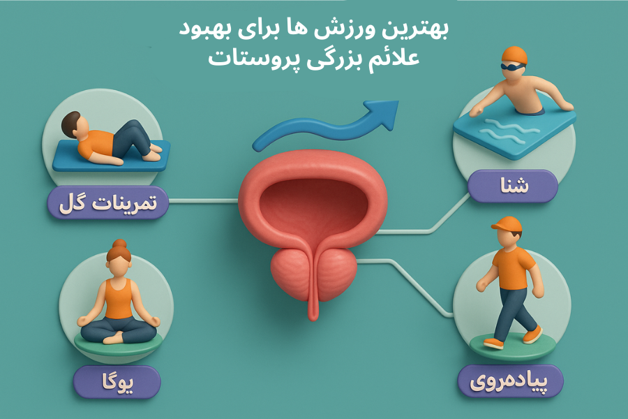 بهترین ورزش ها برای بهبود علائم بزرگی پروستات