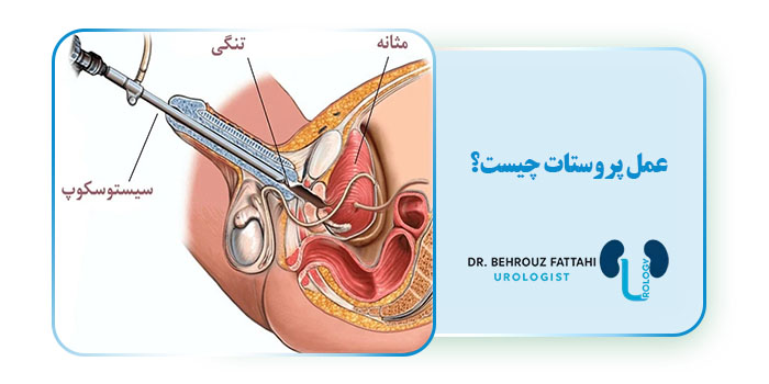 عمل پروستات چیست؟