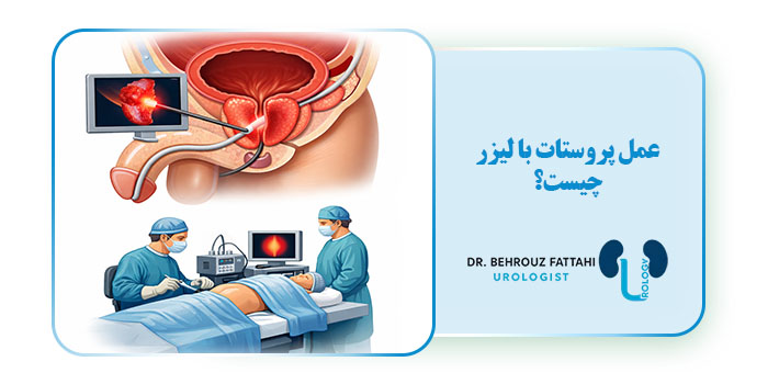 عمل پروستات با لیزر چیست؟