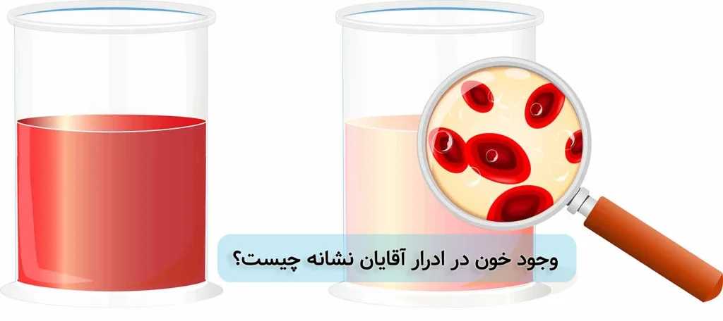 وجود خون در ادرار مردان