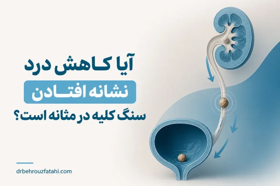 آیا کاهش درد نشانه افتادن سنگ کلیه در مثانه است — مسیر ورود سنگ از حالب به مثانه و تغییر علائم درد پهلو به علائم ادراری